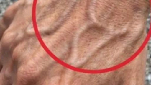 If you have visible veins, it means you are…