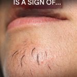 A woman’s chin hair is a sign of…See more