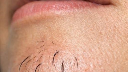 A woman’s chin hair is a sign of…See more