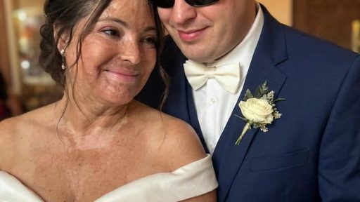 I Married a Blind Man So He’d Never See My Scars – On Our Wedding Night, He Said, ‘You Need to Know the Truth I’ve Been Hiding for 20 Years’